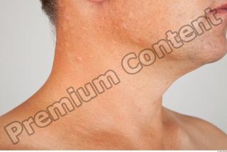 Neck 3D scan texture 0003